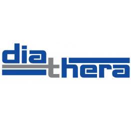 Индикатор внутриглазного давления ИГД-02 «ПРА» Diathera Diathera Офтальмология Medcom